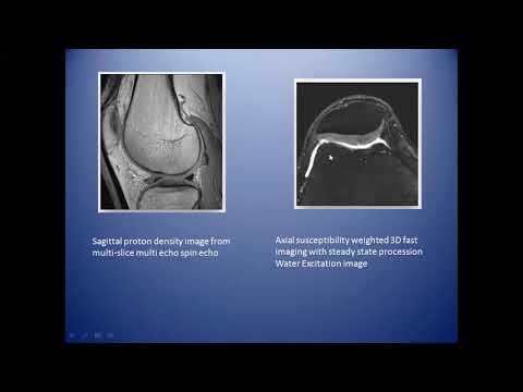 Knee Osteoarthritis Prediction Challenge ( KNOAP 2020)