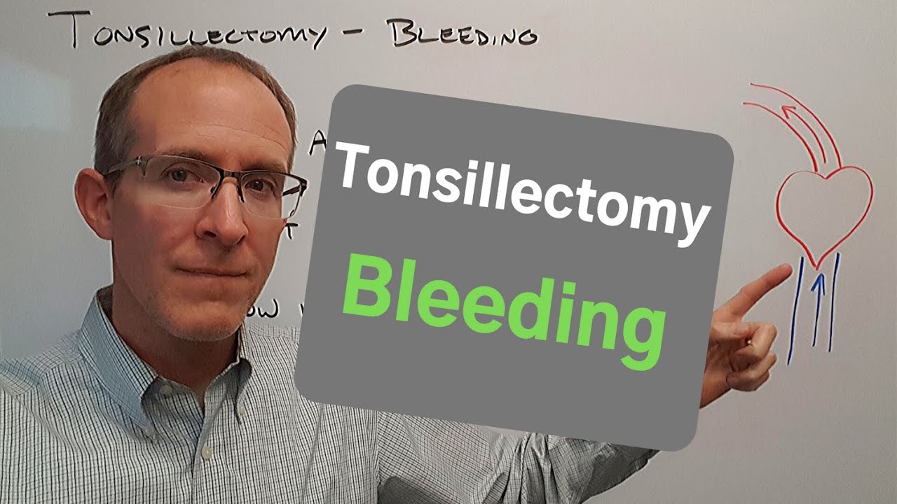 Tonsillectomy Bleeding YouTube Tonsillectomy Bleeding YouTube