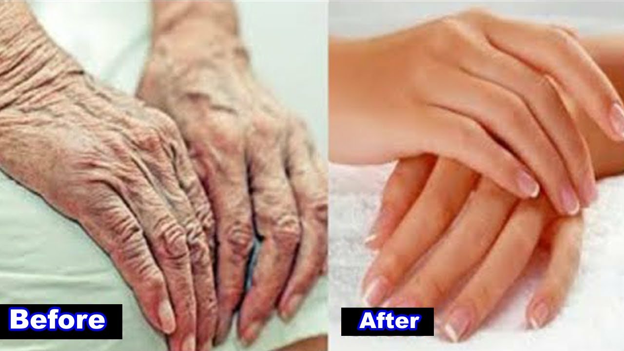 Make Your Hands Look 10 Years Younger Banana Peel - Remove Wrinkles ...