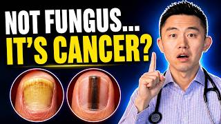 LOOK AT YOUR NAILS RIGHT NOW! 7 Deadly Signs You’re Ignoring