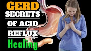 Unlock 8 Proven Ways to Relieve GERD and Acid Reflux