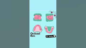 occlusal rim: a cross check on occlusal rim measurements #modelingwax #prosthodontic #occlusion
