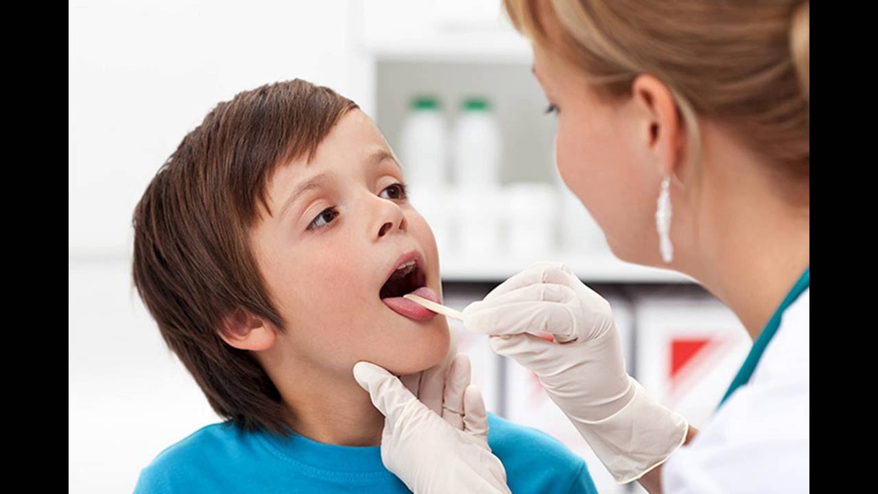 Streptococcal Pharyngitis The Best Treatment Options YouTube
