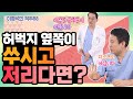 허벅지, 다리가 너무 저리고 아픈데 디스크가 아니다?!  - 이경석의 척추88 #85