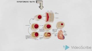 Cardiovascular system presentation