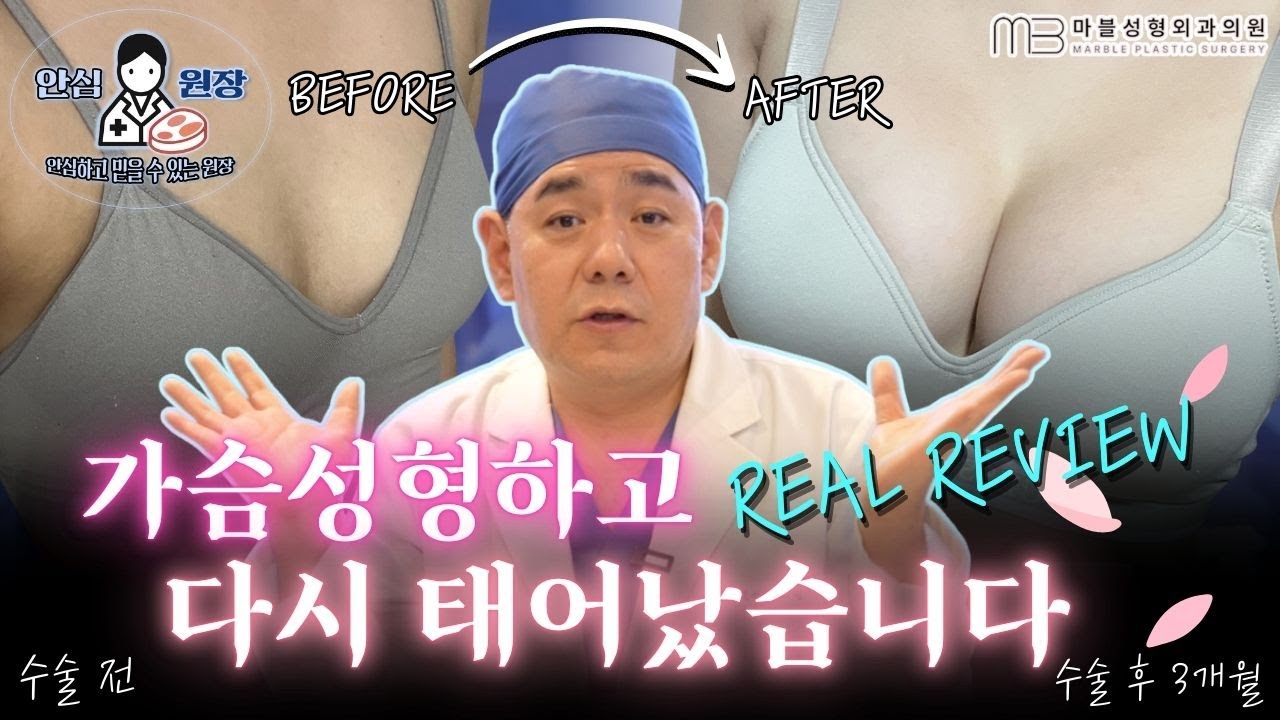 드디어 가슴확대수술 5개월차 후기!!!! feat. 본인등판 (보형물, 절개부위 추천, 수술후 주의사항...)