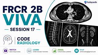 Radiology FRCR 2B Mock Viva and Radiology Interesting Cases