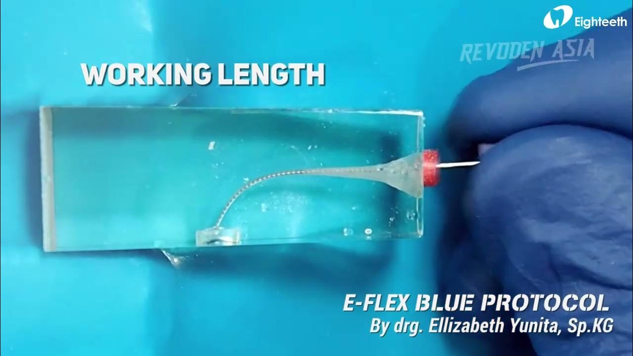 𝐔𝐬𝐚𝐠𝐞 𝐏𝐫𝐨𝐭𝐨𝐜𝐨𝐥 𝐨𝐟 𝐄𝐢𝐠𝐡𝐭𝐞𝐞𝐭𝐡 𝐄𝐧𝐝𝐨 𝐅𝐢𝐥𝐞 𝐄𝐅𝐋𝐄𝐗 𝐁𝐋𝐔𝐄 from Dr. Ellizabeth