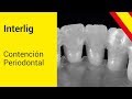 INTERLIG - Contención Periodontal