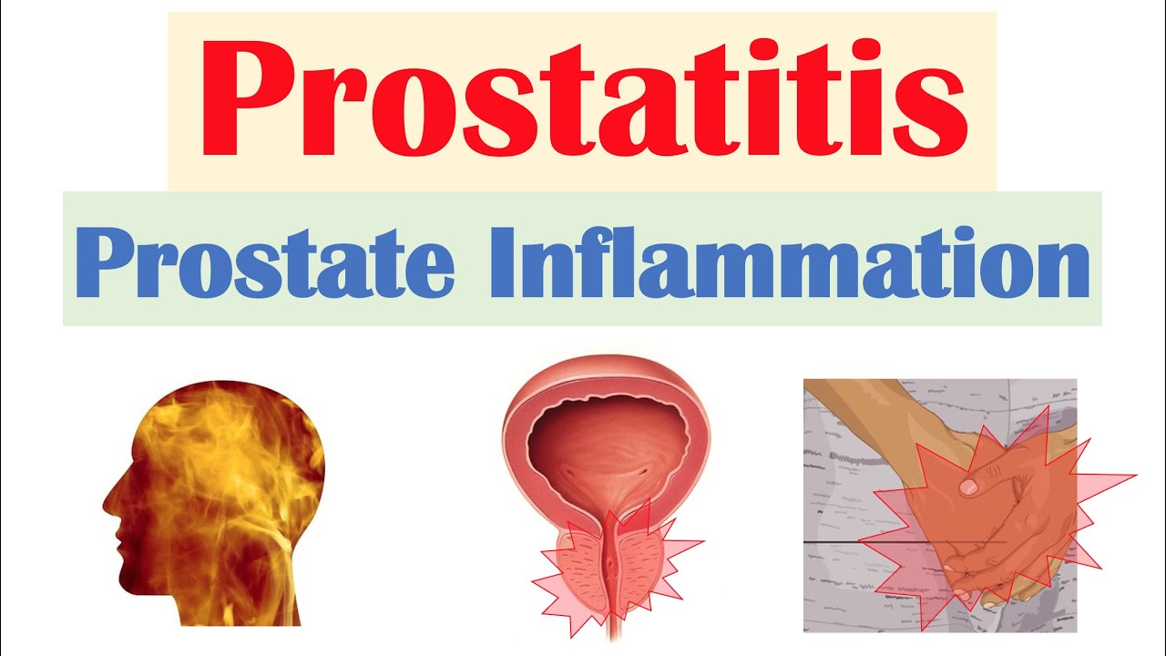 prostatitis vidio)