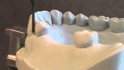 11 Class III Path of Insert