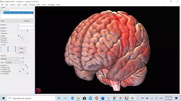 ScreenCapture MRIcroGL Session1