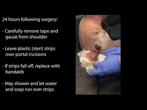 Shoulder Arthroscopy Portals and Wound Care
