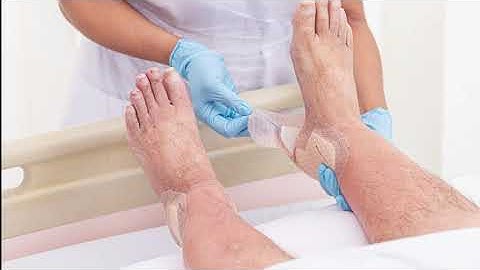 Molnlycke® Turning & Positioning SystemMepilex® Border Sacrum e Mepilex® Border Heel