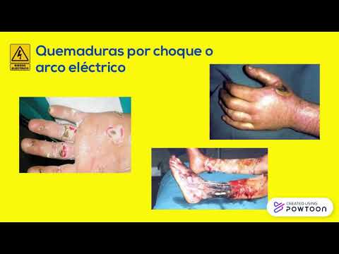 Video: ¿Se requiere que los flebotomistas usen guantes?