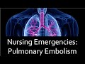 Pulmonary Embolism