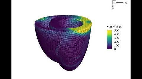 biventricular heart contraction under the action spiral wave