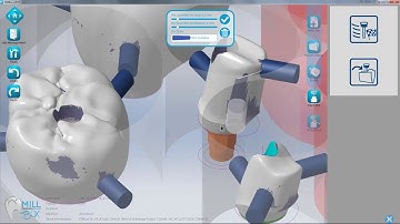 2017 MillBox Abutments Eng