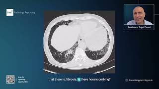 DMCiTutor | How to Read HRCT