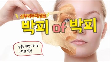 박피중의 박피 강력한 필링 심부피부재생술