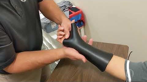 How a custom thumb spica splint is made