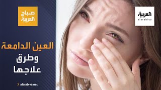 صباح العربية | ما أسباب العين الدامعة وطرق العلاج؟