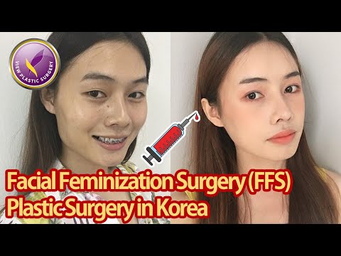 【View Plastic Surgery】 Transgender FFS in Korea