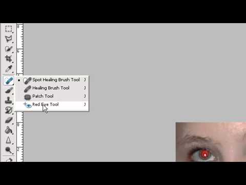 تصویری: نحوه از بین بردن قرمزی چشم