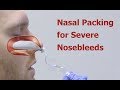 Nasal Packing for Severe Nosebleeds