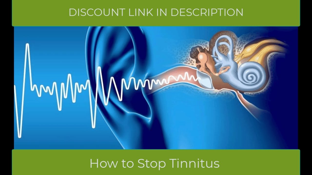 AUDIFORT ✅USER REVIEW!✅ AUDIFORT REVIEWS  – AUDIFORT DROPS   AUDIFORT REVIEW – TINNITUS DROPS