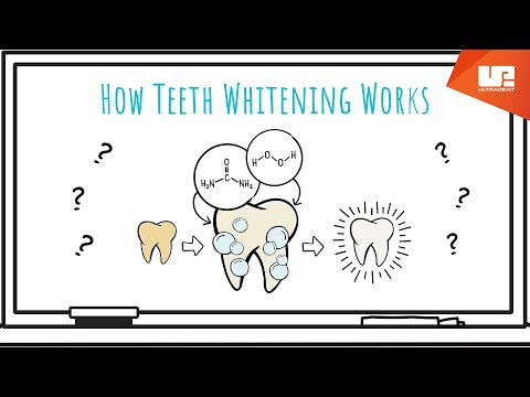 Video: Funguje bělení zubů opalescence?