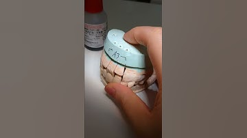 Thumbnail of 【硬質レジン前装冠ブリッジ】新潟市西区小針南台の優しい歯科 西原歯科クリニック