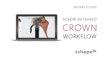 Performing a screw-retained crown workflow in Implant Studio