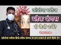 कोरोना मरीज ब्लैक फंगस से बचने के लिए क्या करें? Preventive Tips | Post Covid Mucormycosis in Hindi