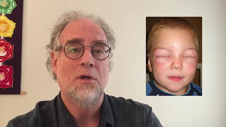 ATH #2: Intro to Homeopathy Part 2 - Law of Similars