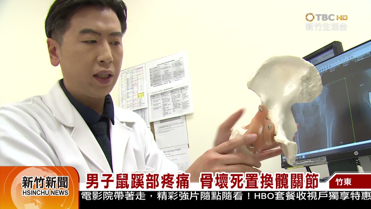 正前開微創人工髖關節置換手術 快速恢復工作與生活 縮圖