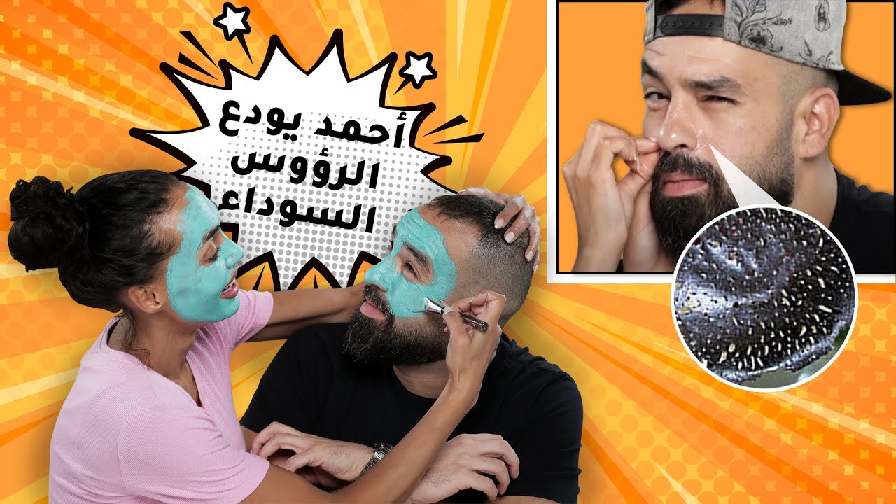 طريقتي في ازالة الرؤوس السوداء من أنف زوجي بخلطة سهلة!! | مع سارة صوفي