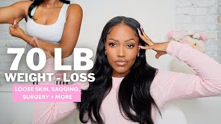 70 LB WEIGHTLOSS BODY CHANGES + TIPS | LOOSE SKIN, SAGGING, STRETCH MARKS + MORE