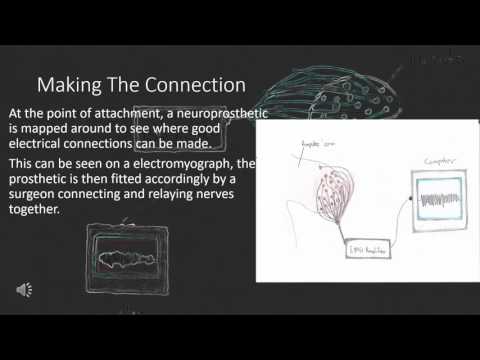 Video: Neuroprosthesis FES Multichannel Adaptif Dengan Kontrol Pembelajaran Dan Penilaian Gaya Berjalan Otomatis