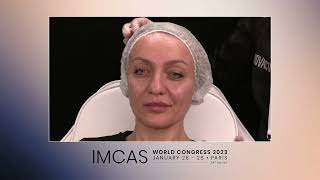 IMCAS Paris Marina Landau (part 2) screenshot 5