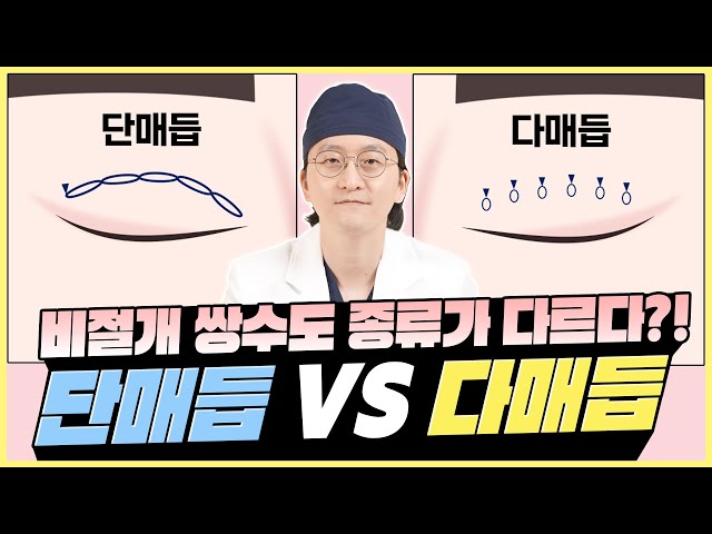 쌍수, 매듭에 따라서 결과가 달라진다! - 닥터 김태훈