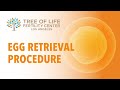 Egg Retrieval Procedure