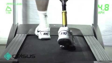 Celsus - Treadmill Foot Function Analysis