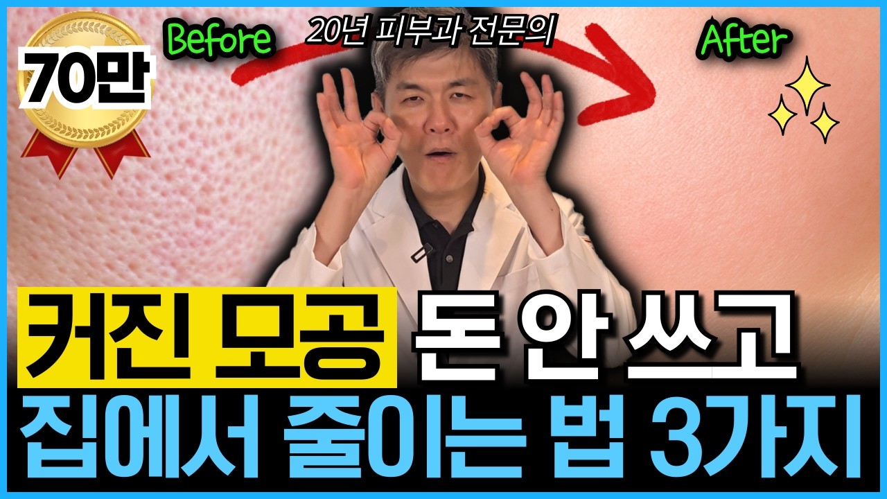 “시술 없이 됩니다” 수백만원 아끼는 집에서 모공 줄이는 방법을 20년차 피부과 원장이 직접 하는 동안시술 3가지를 알려드립니다
