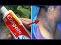 How to Get Rid of Dark Neck Fast and Easy | Brown skin around neck || Natural Remedy