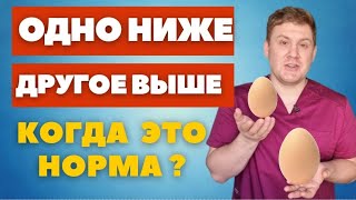 Яички висят на разном уровне // Одно выше, а другое ниже // Когда это норма