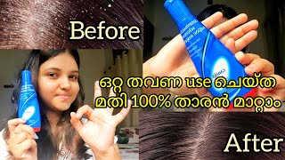 Say bye bye to dandruff | ഇത് ഉണ്ടെങ്കിൽ dandruff ഉണ്ടാവില്ല | ഒറ്റ യുഎസിൽ dandruff മാറ്റാം| .