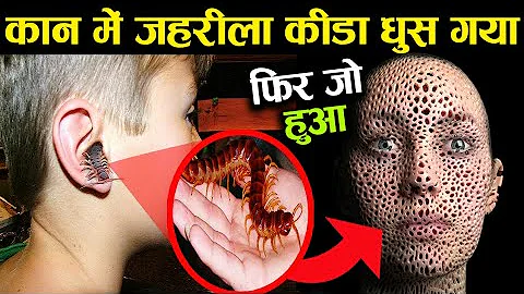 कान में जहरीला कीड़ा घुस गया फिर जो हुआ देखकर डॉ भी हैरान रह गए ! remove insect from ear, animals