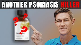 Best Psoriasis Treatment Supplement | How to Get Rid of Psoriasis Naturally