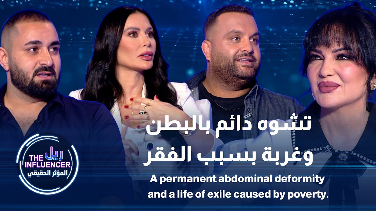 لأنها تأثرت بالإعلانات صار معها تشوه دائم بالبطن ، وفواز ندمان إنه تغرب وبعد عن أبوه